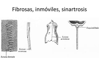 Fibrosas, inmóviles, sinartrosis
 