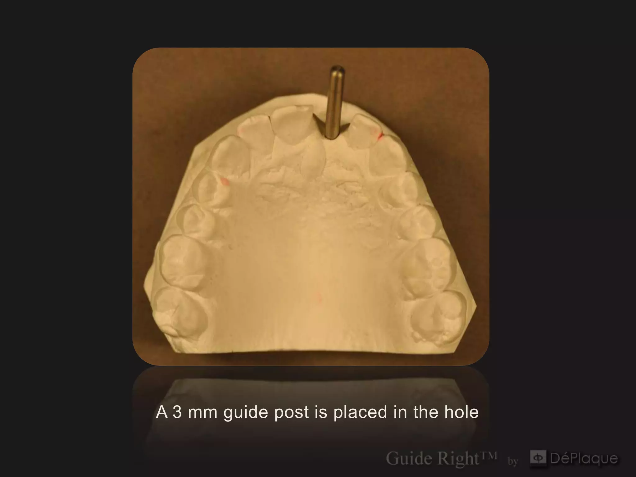 A 3 mm guide post is placed in the hole
 