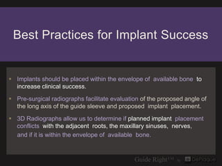 Best Practices for Implant Success


 Implants should be placed within the envelope of available bone to
  increase clini...