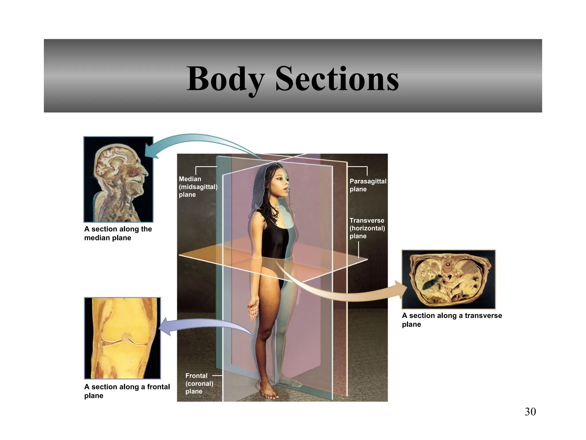 30
Body Sections
A section along a frontal
plane
A section along a transverse
plane
A section along the
median plane
Transverse
(horizontal)
plane
Frontal
(coronal)
plane
Parasagittal
plane
Median
(midsagittal)
plane
 