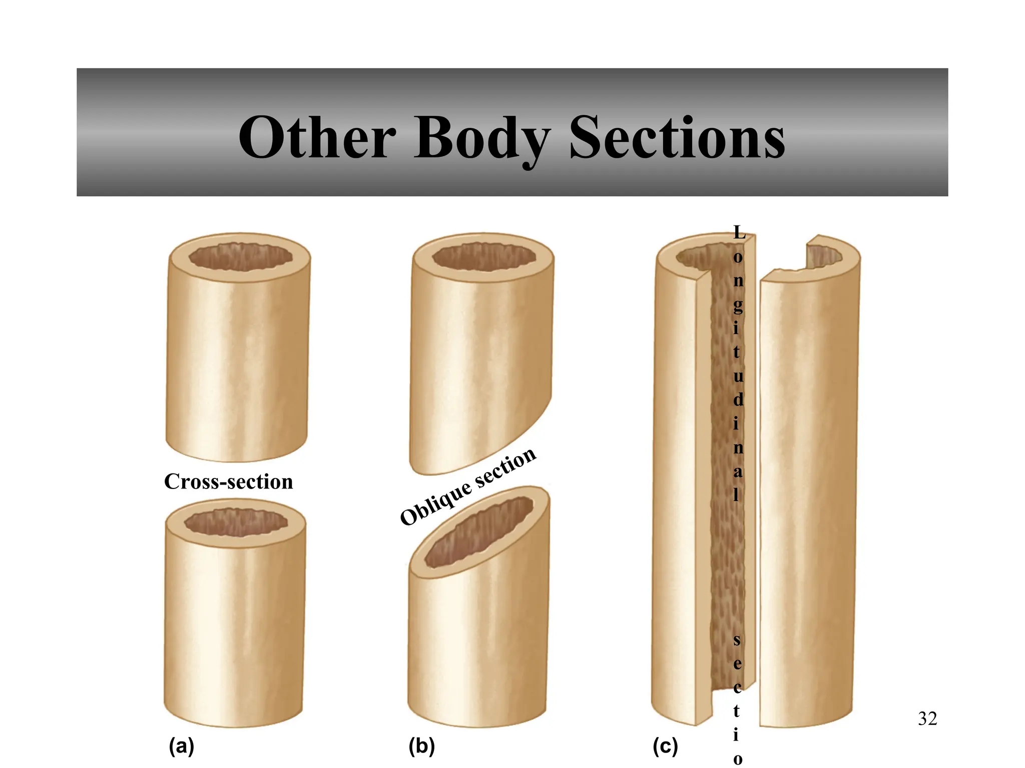 32
Other Body Sections
(a) (b) (c)
Cross-section
Oblique section
L
o
n
g
i
t
u
d
i
n
a
l
s
e
c
t
i
o
 
