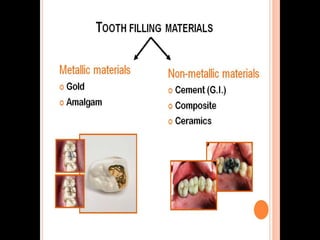 Cavity Filling Material