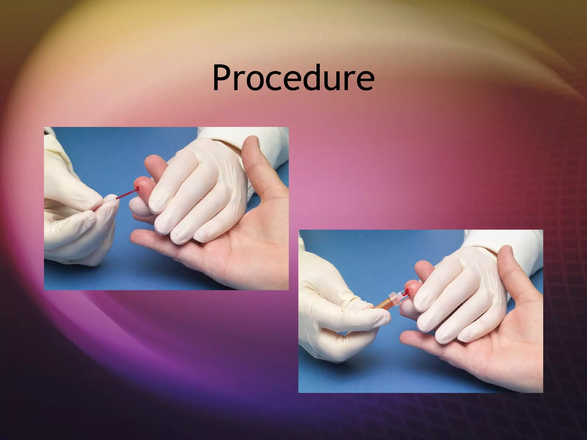 Procedure 