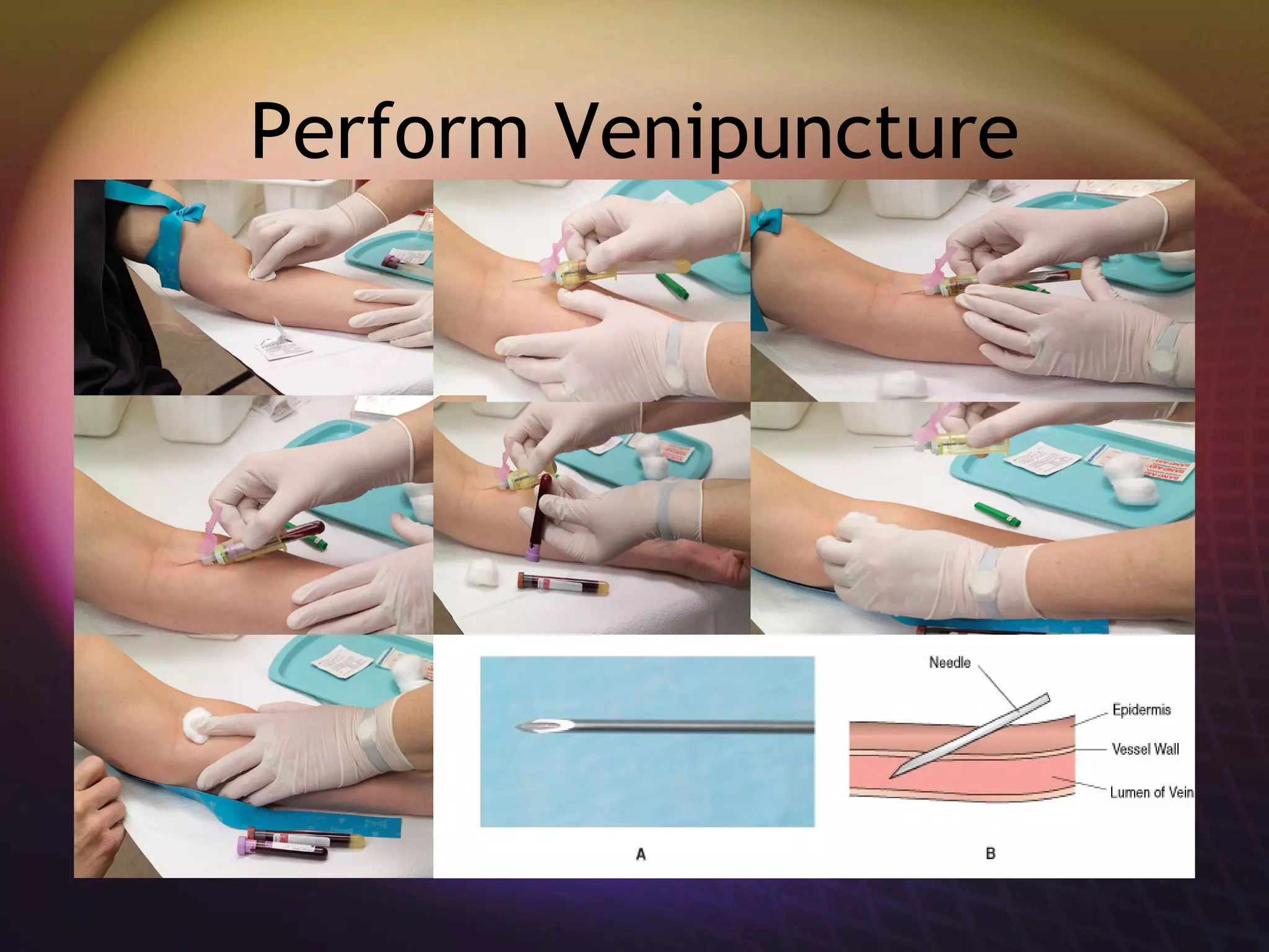 Perform Venipuncture 