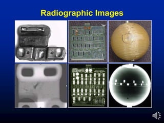 Radiographic Images
 
