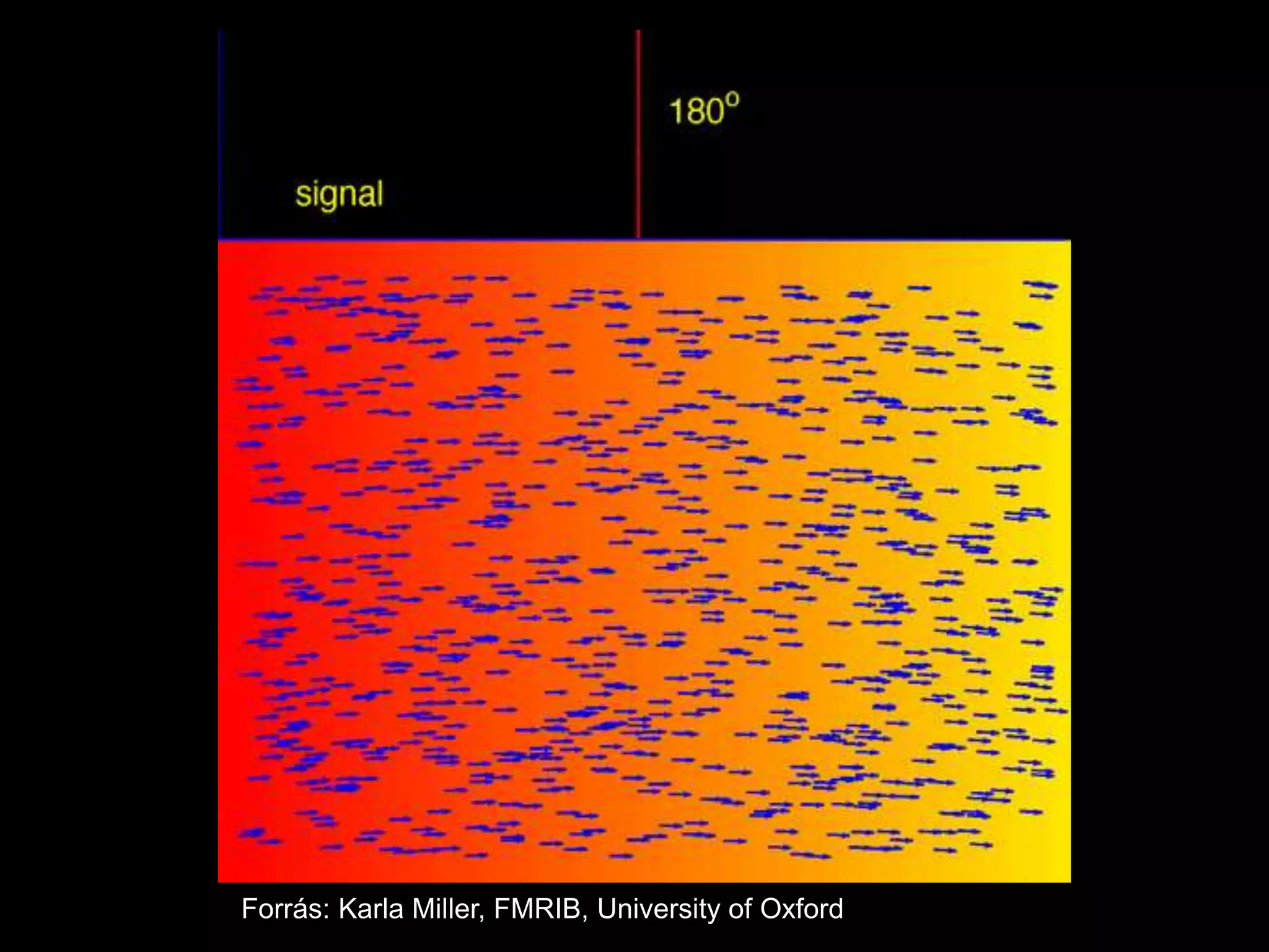 Forrás: Karla Miller, FMRIB, University of Oxford
 