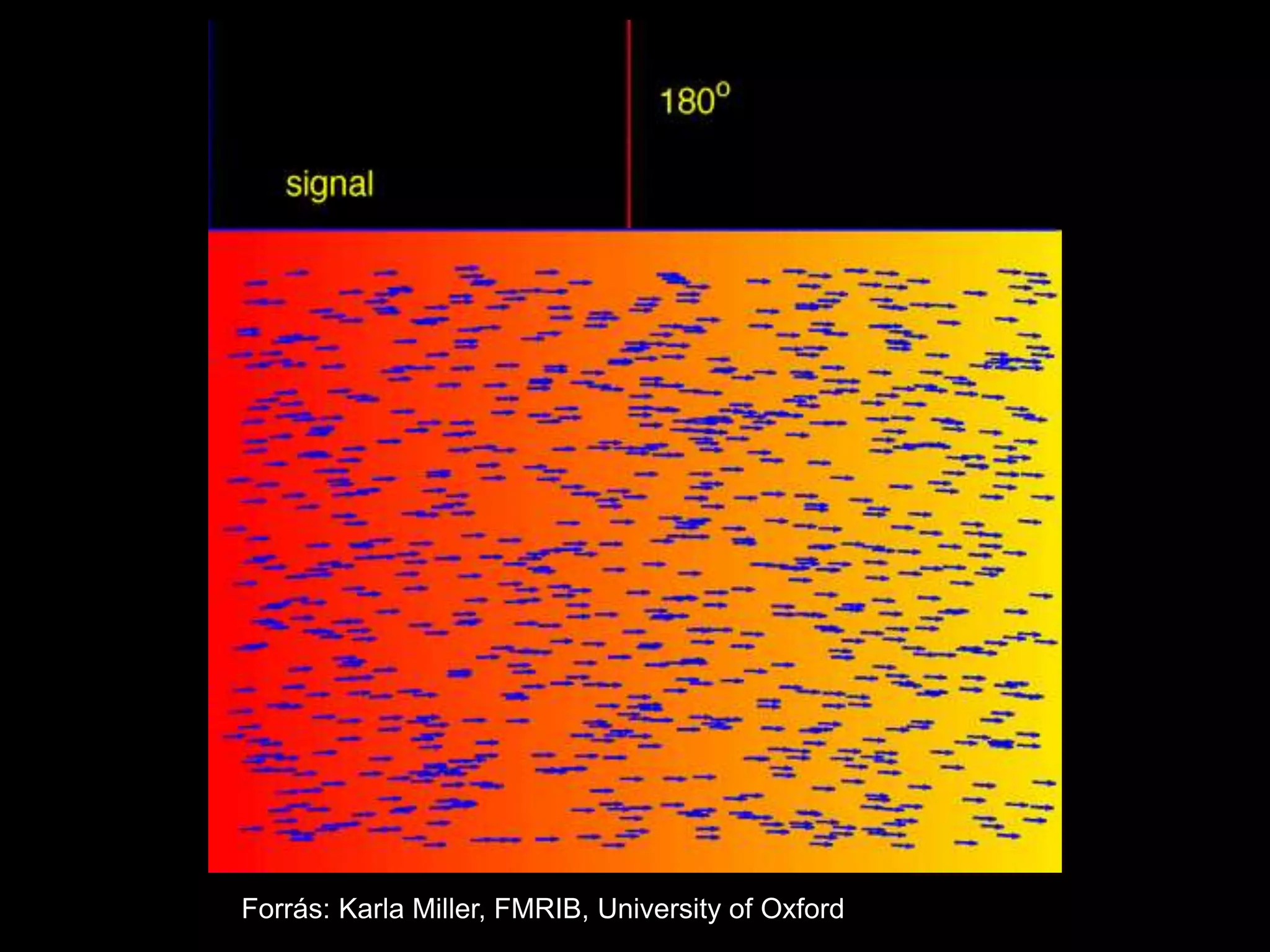 Forrás: Karla Miller, FMRIB, University of Oxford
 