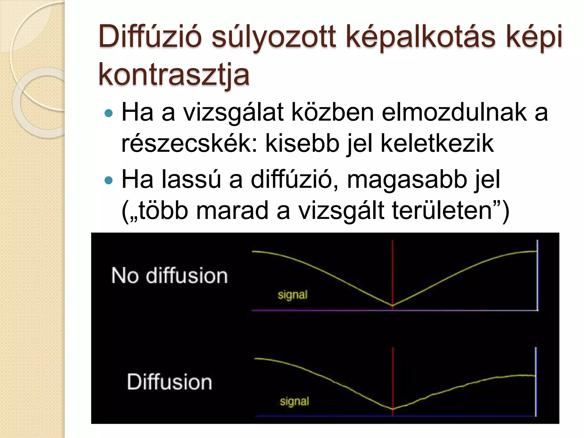 Diffúzió súlyozott képalkotás képi
kontrasztja
 Ha a vizsgálat közben elmozdulnak a
részecskék: kisebb jel keletkezik
 Ha lassú a diffúzió, magasabb jel
(„több marad a vizsgált területen”)
 