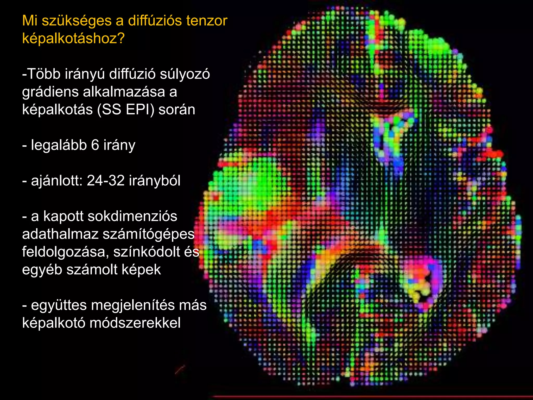 Mi szükséges a diffúziós tenzor
képalkotáshoz?
-Több irányú diffúzió súlyozó
grádiens alkalmazása a
képalkotás (SS EPI) során
- legalább 6 irány
- ajánlott: 24-32 irányból
- a kapott sokdimenziós
adathalmaz számítógépes
feldolgozása, színkódolt és
egyéb számolt képek
- együttes megjelenítés más
képalkotó módszerekkel
 