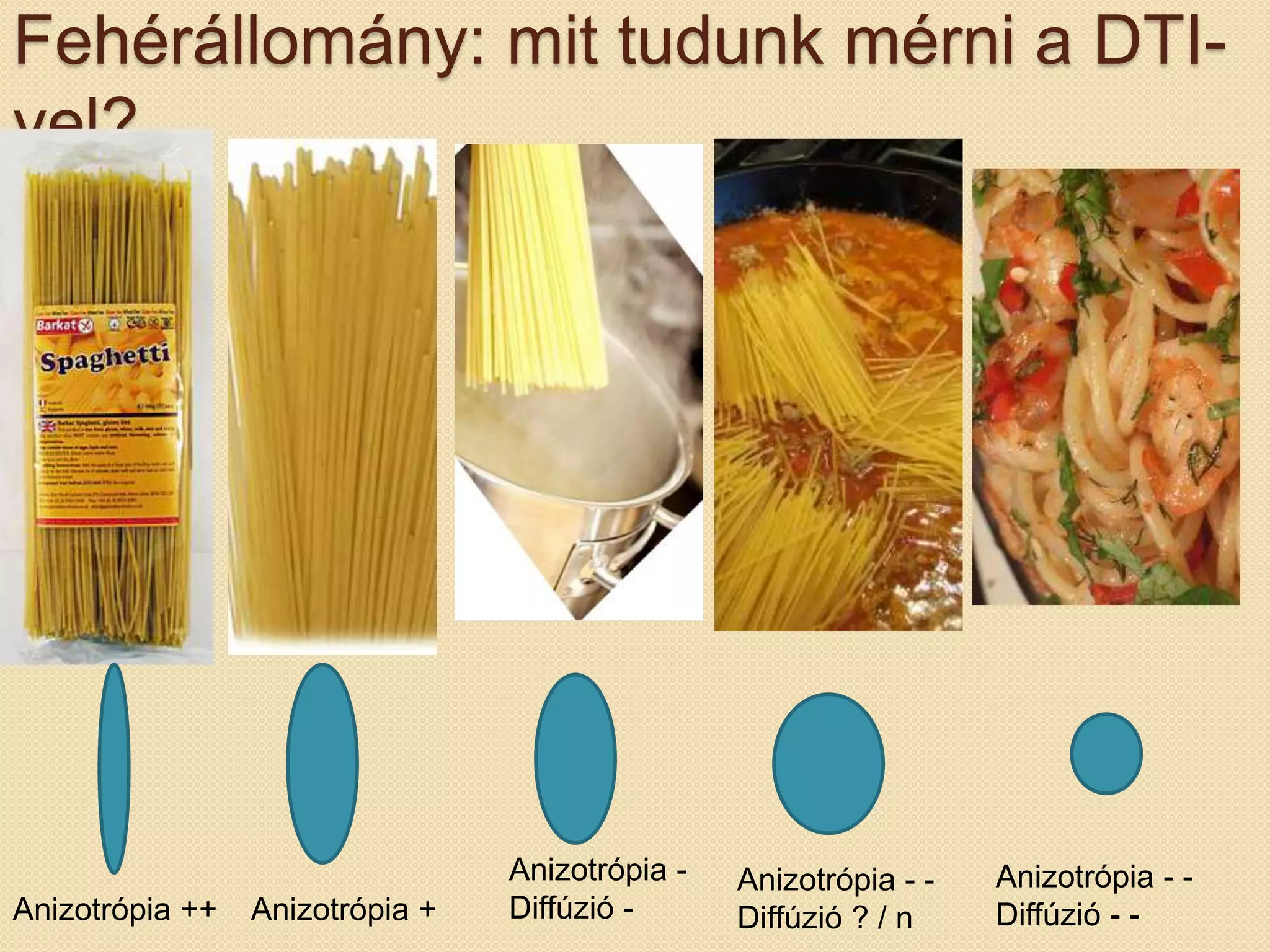Fehérállomány: mit tudunk mérni a DTI-
vel?
Anizotrópia ++ Anizotrópia +
Anizotrópia -
Diffúzió -
Anizotrópia - -
Diffúzió ? / n
Anizotrópia - -
Diffúzió - -
 