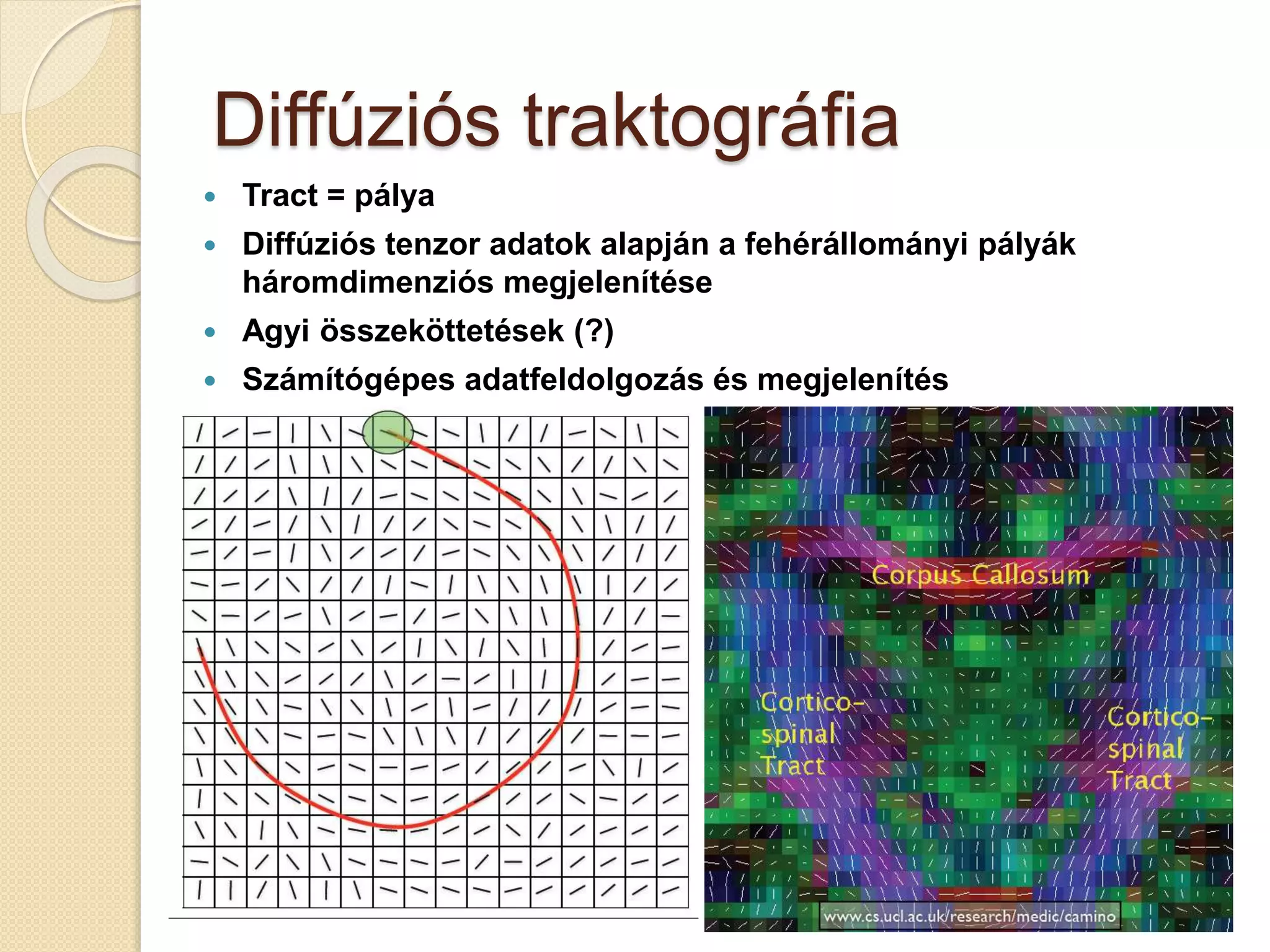 Diffúziós traktográfia
 Tract = pálya
 Diffúziós tenzor adatok alapján a fehérállományi pályák
háromdimenziós megjelenítése
 Agyi összeköttetések (?)
 Számítógépes adatfeldolgozás és megjelenítés
 