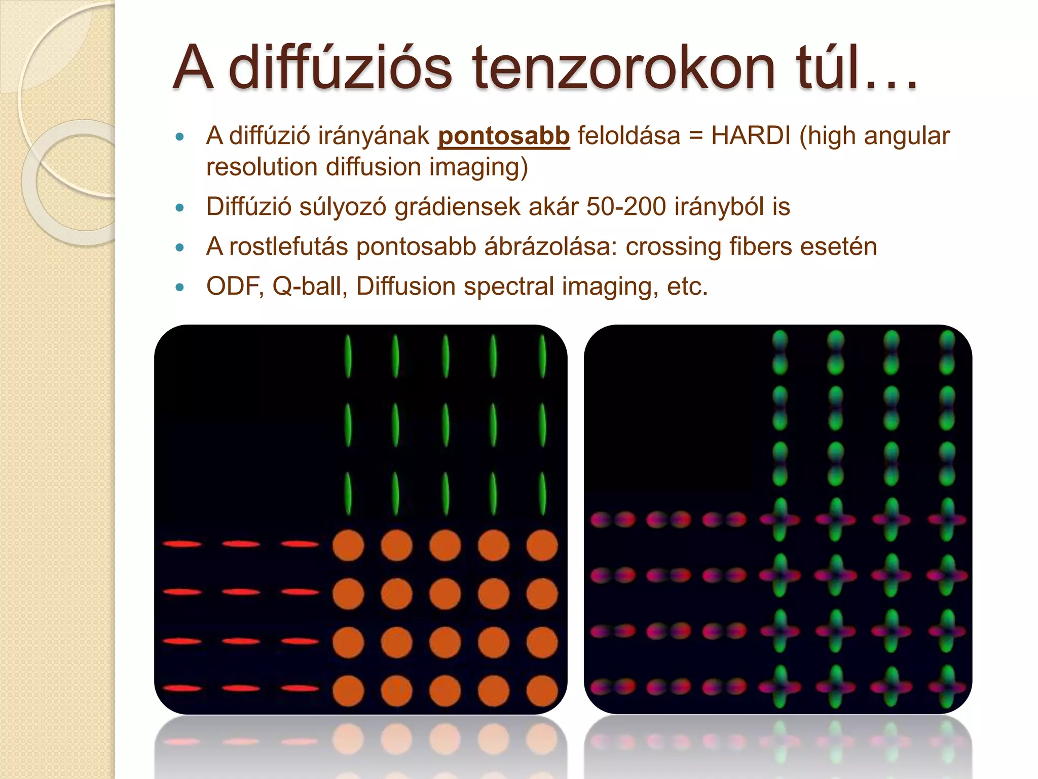 A diffúziós tenzorokon túl…
 A diffúzió irányának pontosabb feloldása = HARDI (high angular
resolution diffusion imaging)
 Diffúzió súlyozó grádiensek akár 50-200 irányból is
 A rostlefutás pontosabb ábrázolása: crossing fibers esetén
 ODF, Q-ball, Diffusion spectral imaging, etc.
 
