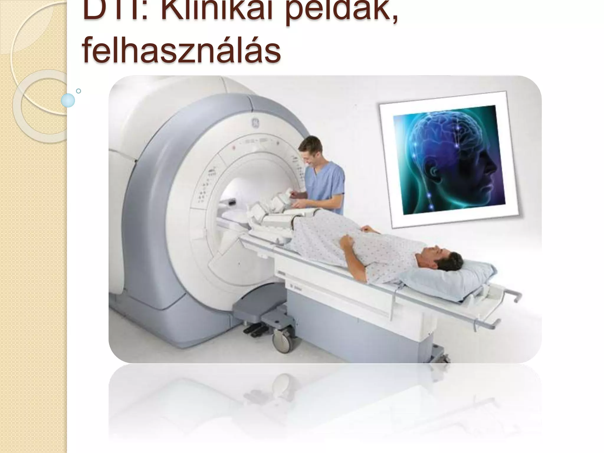 DTI: Klinikai példák,
felhasználás
 
