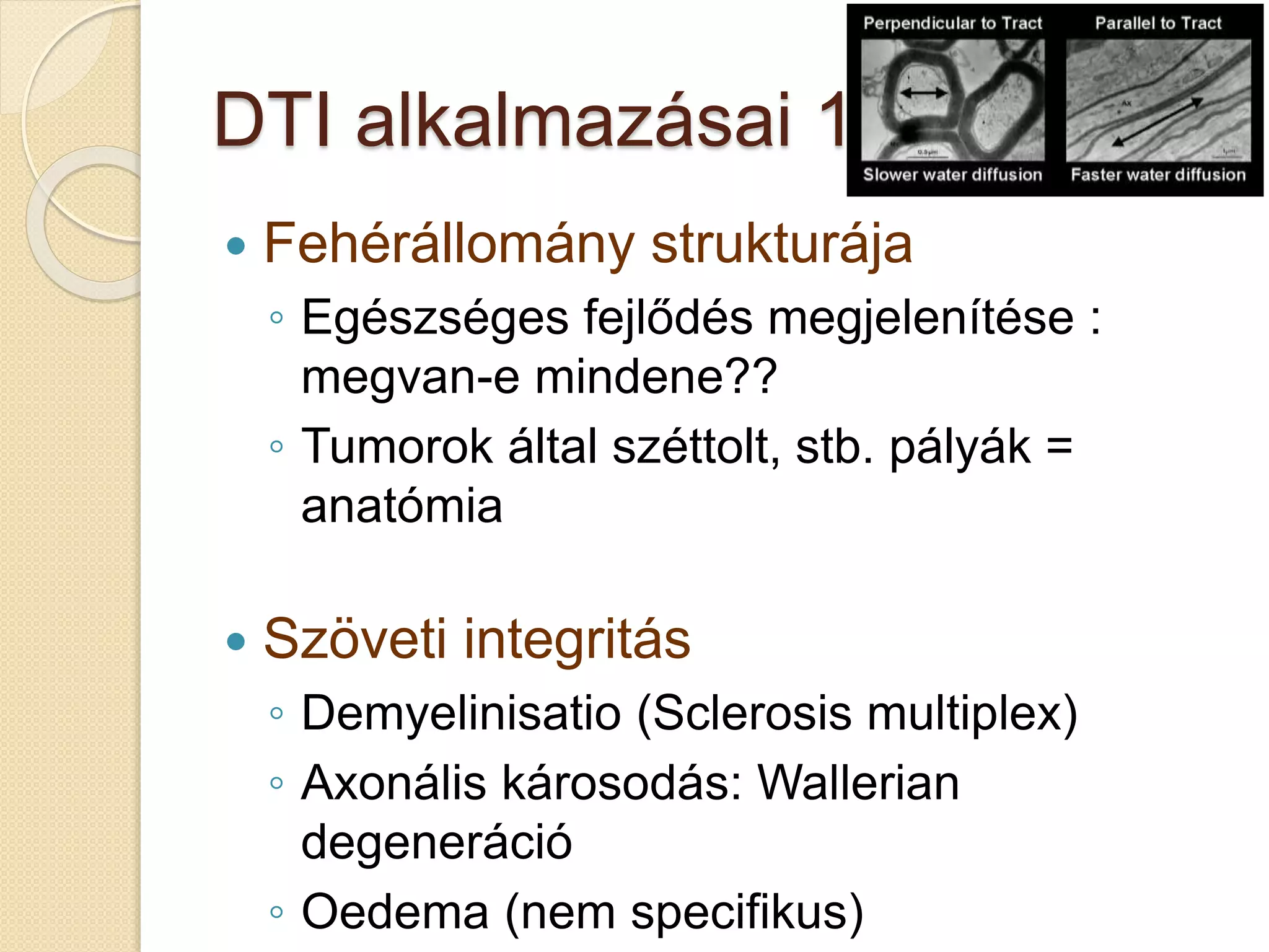 DTI alkalmazásai 1.
 Fehérállomány strukturája
◦ Egészséges fejlődés megjelenítése :
megvan-e mindene??
◦ Tumorok által széttolt, stb. pályák =
anatómia
 Szöveti integritás
◦ Demyelinisatio (Sclerosis multiplex)
◦ Axonális károsodás: Wallerian
degeneráció
◦ Oedema (nem specifikus)
 