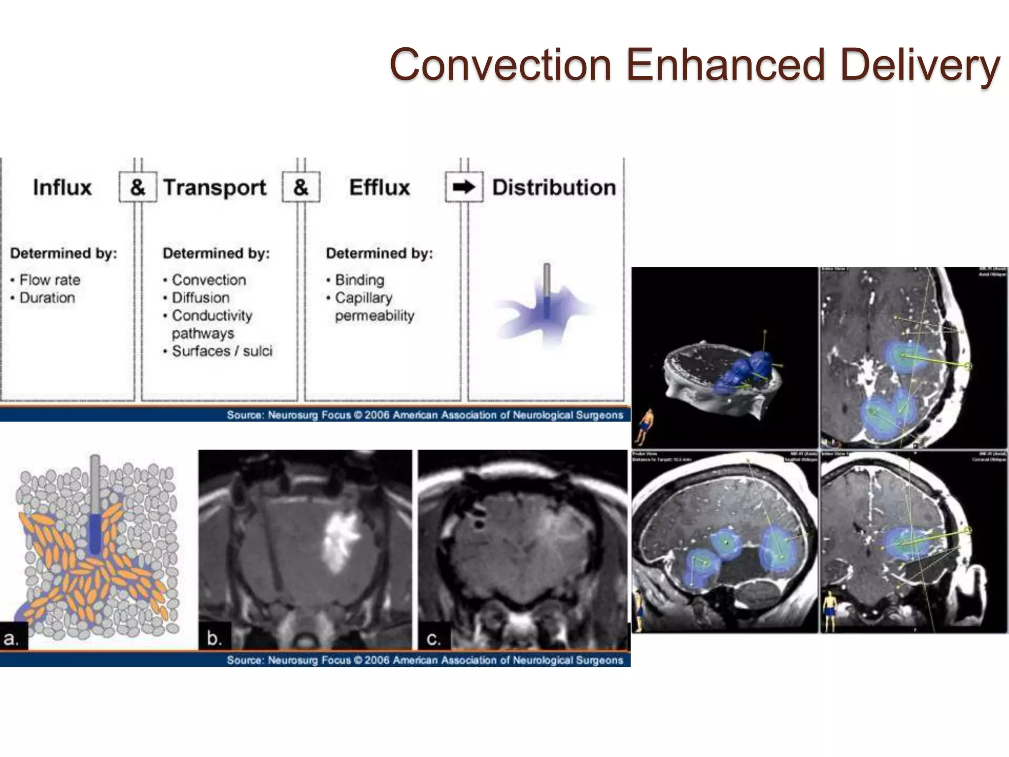Convection Enhanced Delivery
 
