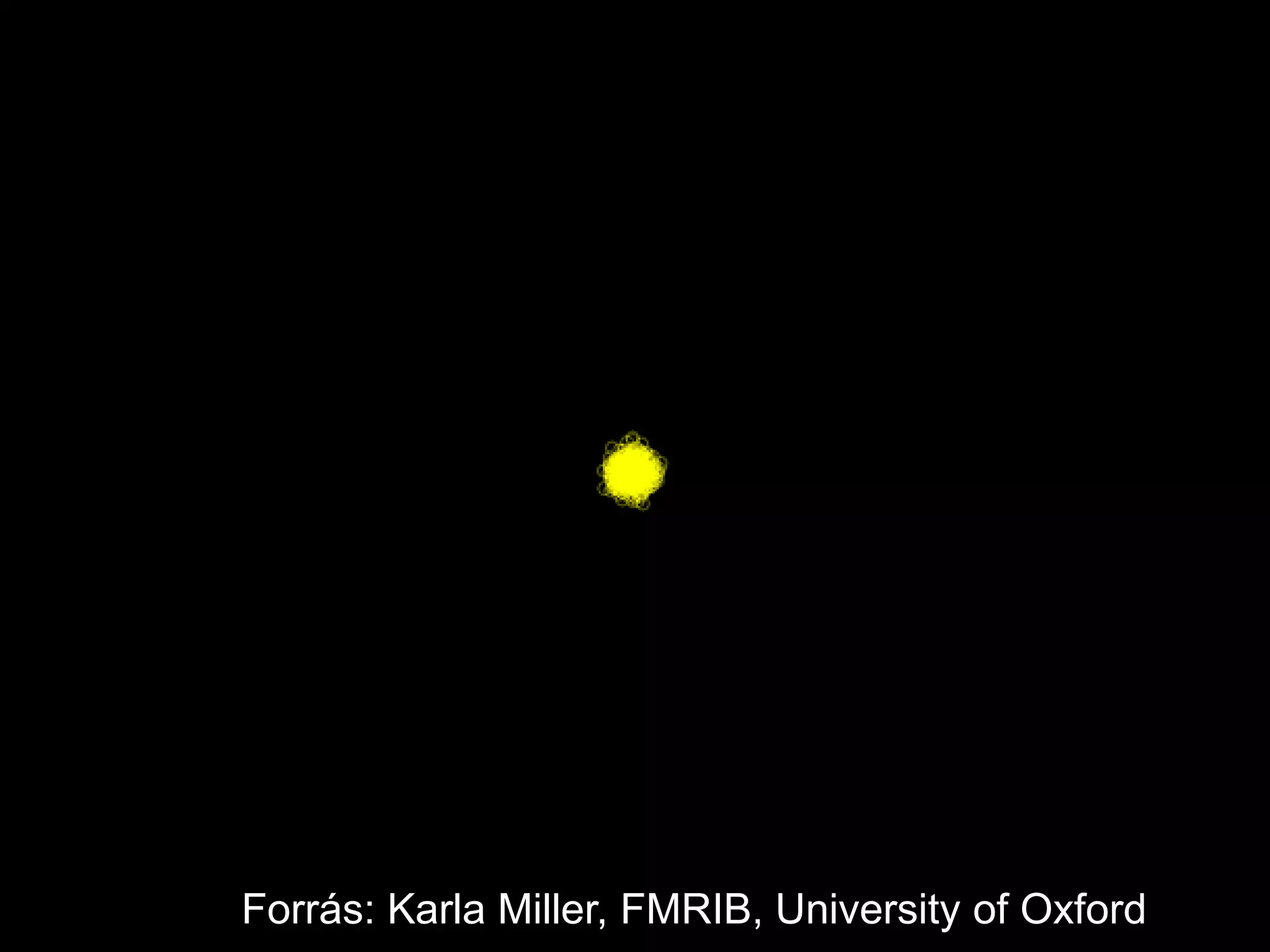 Forrás: Karla Miller, FMRIB, University of Oxford
 