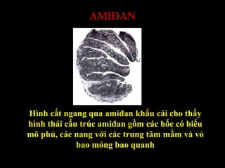 AMIĐAN
Hình cắt ngang qua amiđan khẩu cái cho thấy
hình thái cấu trúc amiđan gồm các hốc có biểu
mô phủ, các nang với các trung tâm mầm và vỏ
bao mỏng bao quanh
 