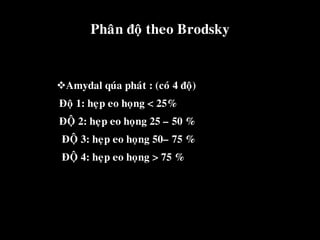 Phaân ñoä theo Brodsky
Amydal quùa phaùt : (coù 4 ñoä)
Ñoä 1: heïp eo hoïng < 25%
ÑOÄ 2: heïp eo hoïng 25 – 50 %
ÑOÄ 3: heïp eo hoïng 50– 75 %
ÑOÄ 4: heïp eo hoïng > 75 %
 