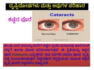 eyes - Meaning in Kannada visual data 4