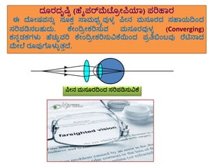 eyes - Meaning in Kannada visual data 5