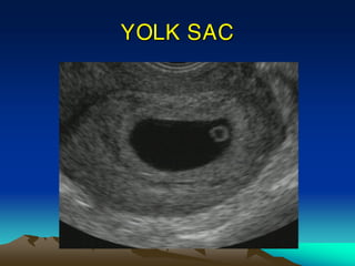YOLK SAC
 