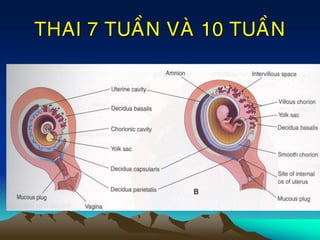THAI 7 TUAÀN VAØ 10 TUAÀN
 
