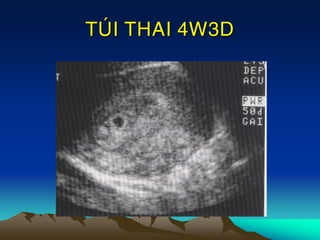TUÙI THAI 4W3D
 