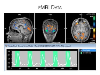 FMRI DATA
 