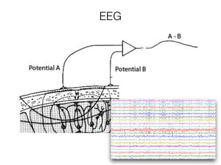 EEG
 