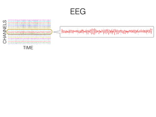 EEG
TIME
CHANNELS
 