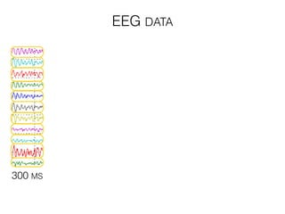 300 MS
EEG DATA
 