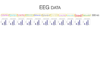 300 MS
EEG DATA
 