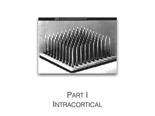 PART I
INTRACORTICAL
 