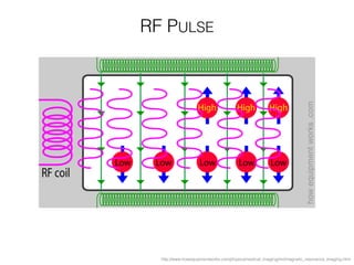 http://www.howequipmentworks.com/physics/medical_imaging/mri/magnetic_resonance_imaging.html
RF PULSE
 