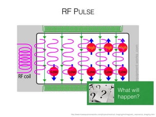http://www.howequipmentworks.com/physics/medical_imaging/mri/magnetic_resonance_imaging.html
RF PULSE
What will
happen?
 