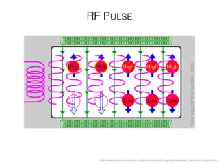 http://www.howequipmentworks.com/physics/medical_imaging/mri/magnetic_resonance_imaging.html
RF PULSE
 