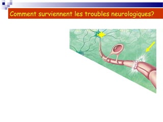 11
Comment surviennent les troubles neurologiques?
 