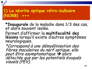 14
1) La névrite optique rétro-bulbaire
(NORB) +++
*Inaugurale de la maladie dans 1/3 des cas,
et alors souvent isolée.
Permet d’affirmer la multifocalité des
lésions lorsqu’il existe d’autres symptômes
neurologiques.
*Correspond à une démyélinisation des
fibres maculaires du nerf optique, elle
peut être asymptomatique  alors
détectée que par les potentiels évoqués
visuels (PEV).
 