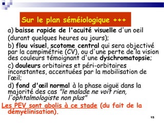 15
Sur le plan séméiologique +++
a) baisse rapide de l'acuité visuelle d'un oeil
(durant quelques heures ou jours);
b) flou visuel, scotome central qui sera objectivé
par la campimétrie (CV), ou d'une perte de la vision
des couleurs témoignant d'une dyschromatopsie;
c) douleurs orbitaires et péri-orbitaires
inconstantes, accentuées par la mobilisation de
l’œil;
d) fond d'œil normal à la phase aiguë dans la
majorité des cas "le malade ne voit rien,
l'ophtalmologiste non plus"
Les PEV sont abolis à ce stade (du fait de la
démyélinisation).
 