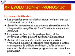 42
X- EVOLUTION et PRONOSTIC
La forme rémittente :
 Les poussées sont résolutives (spontanément ou sous
traitement corticoïde).
 Evolution spontanée le plus souvent favorable vers la
récupération complète de l’acuité visuelle en quelques
semaines.
 La grossesse (surtout le post-partum), et les
infections virales peuvent favoriser les poussées.
 Au fur et à mesure de l'évolution les poussées
franches diminuent d'intensité mais chacune d'entre
elles aggrave le déficit antérieur. L'affection est
alors entrée dans sa phase progressive avec handicap
permanent,
 
