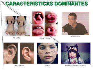 CARACTERÍSTICAS DOMINANTESCARACTERÍSTICAS DOMINANTES
Polidactilia Dobrar a língua
Lobo da orelha Sardas Covinhas nas bochechas/queixo
Bico de viúva
 