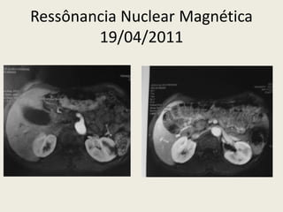 Ressônancia Nuclear Magnética
        19/04/2011
 