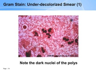 Page 14
Gram Stain: Under-decolorized Smear (1)
Note the dark nuclei of the polys
 