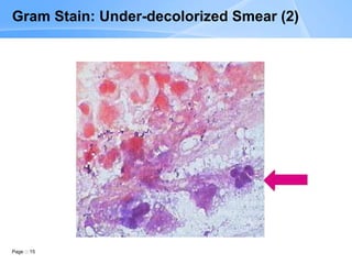 Page 15
Gram Stain: Under-decolorized Smear (2)
 