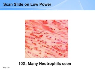 Page 22
10X: Many Neutrophils seen
Scan Slide on Low Power
 