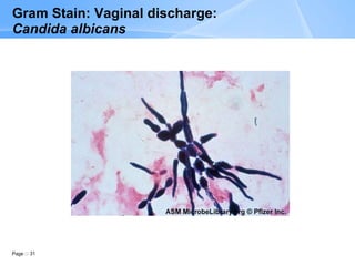 Page 31
Gram Stain: Vaginal discharge:
Candida albicans
 