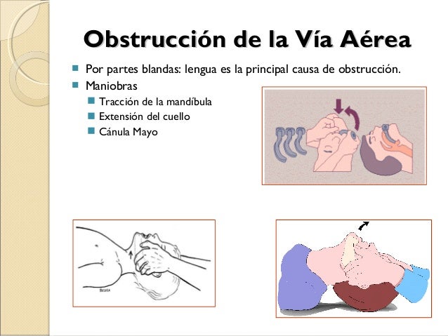 1 manejo de la via aerea