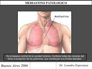 MEDIASTINO PATOLOGICO
Buenos Aires 2006 Dr. Leandro Esperanza
Es el espacio central de la cavidad torácica. Contiene todas las vísceras del
tórax a excepción de los pulmones, que constituyen sus límites laterales.
 