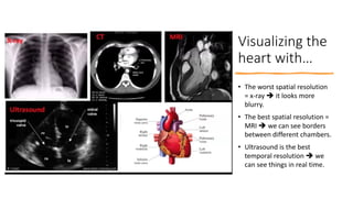 Visualizing the
heart with…
• The worst spatial resolution
= x-ray ➔ it looks more
blurry.
• The best spatial resolution =...