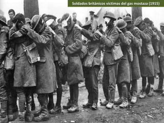 Soldados británicos víctimas del gas mostaza (1915)
 